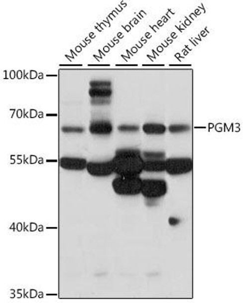 Anti-PGM3 Antibody (CAB15698)