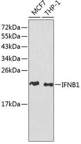 Anti-IFNB1 Antibody (CAB1575)