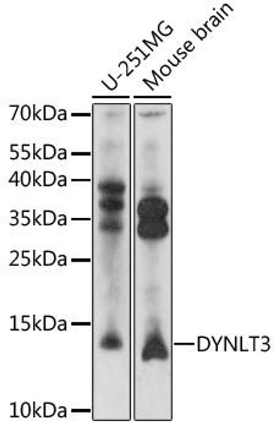 Anti-DYNLT3 Antibody (CAB16982)