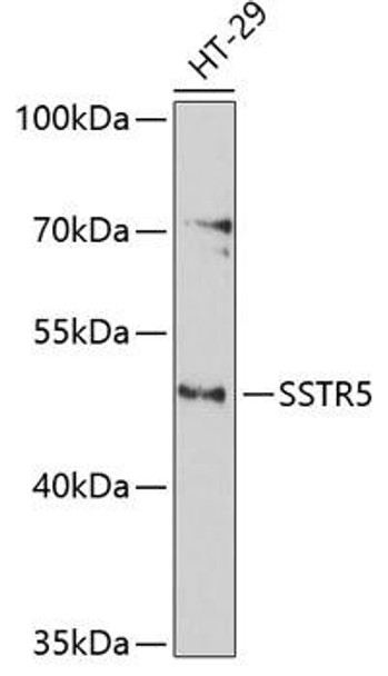 Anti-SSTR5 Antibody (CAB3136)