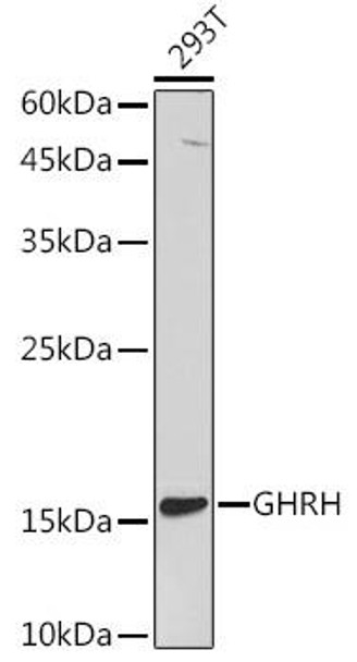 Anti-GHRH Antibody (CAB5343)