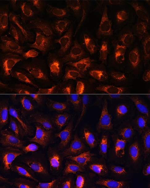 Anti-CART Antibody (CAB5395)