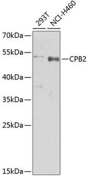 Anti-CPB2 Antibody (CAB5634)
