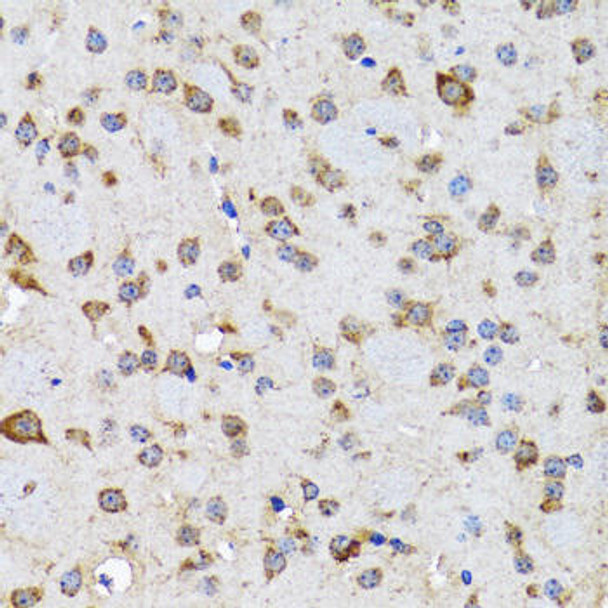 Anti-EFNB2 Antibody (CAB5669)