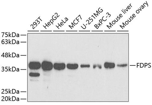 Anti-FDPS Antibody (CAB5744)