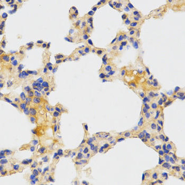 Anti-ATG3 Antibody (CAB5809)