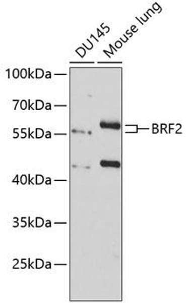 Anti-BRF2 Antibody (CAB8782)