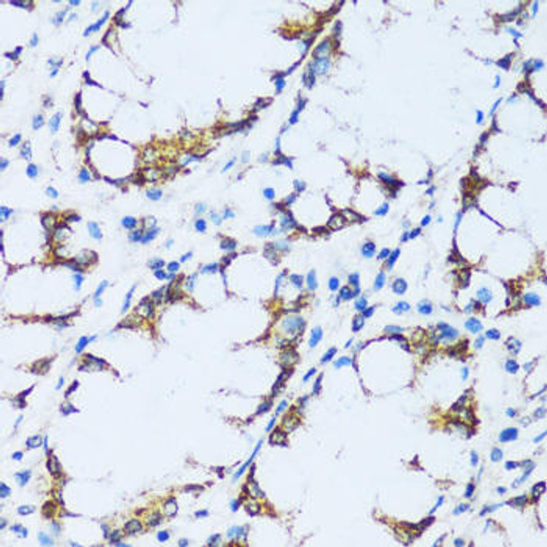 Anti-C1QC Antibody (CAB9227)