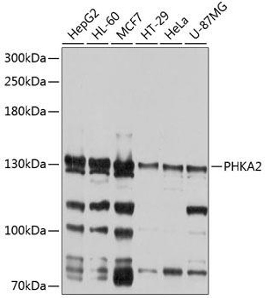 Anti-PHKA2 Antibody (CAB9636)
