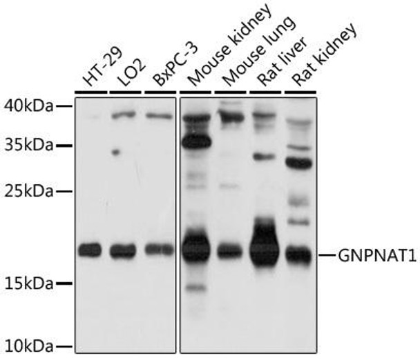 Anti-GNPNAT1 Antibody (CAB17759)