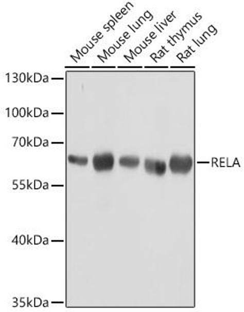 Anti-RELA Mouse Monoclonal Antibody (CAB18210)