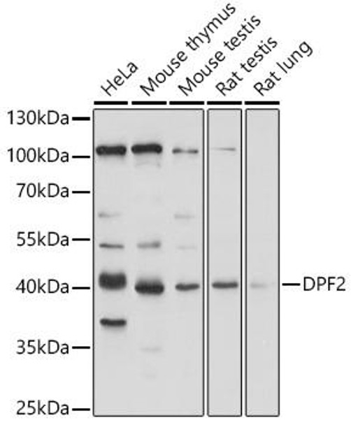 Anti-DPF2 Antibody (CAB18258)