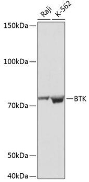 Anti-BTK Antibody (CAB19002)