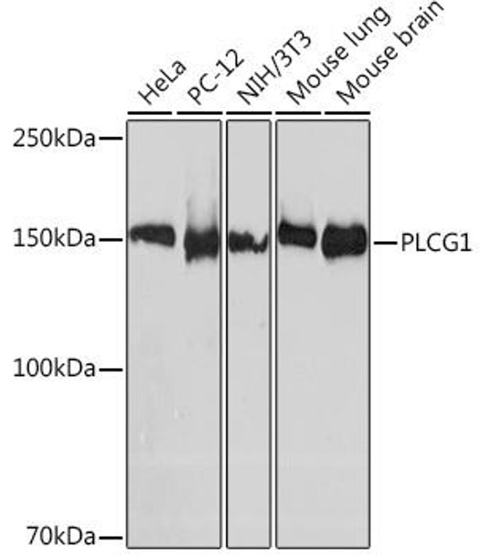 Anti-PLCG1 Antibody (CAB8899)