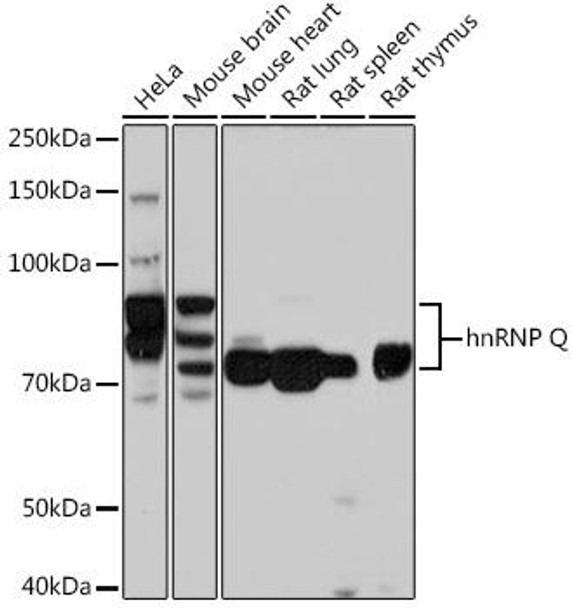 Anti-hnRNP Q Antibody (CAB9609)
