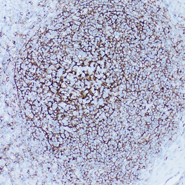 Anti-CD35/CR1 Antibody (CAB3661)