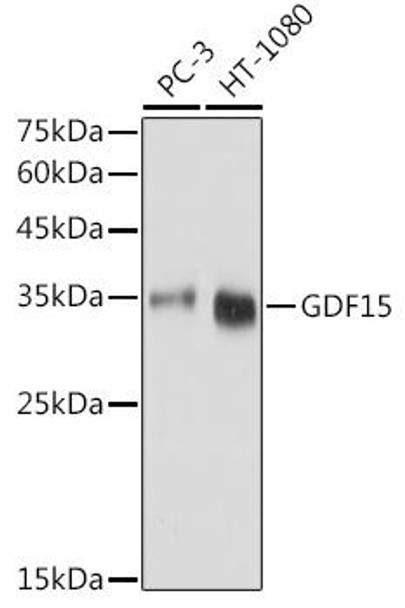 Anti-GDF15 Antibody (CAB0185)