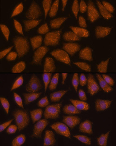 Anti-GCLC Antibody (CAB1038)