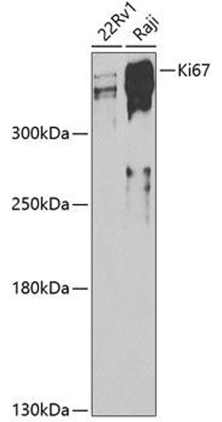 Anti-Ki67 Antibody (CAB11390)