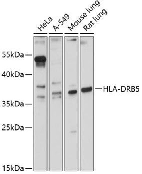 Anti-HLA-DRB5 Antibody (CAB12726)