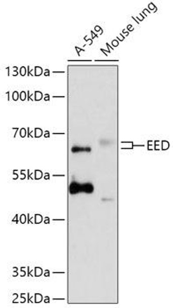 Anti-EED Antibody (CAB12776)