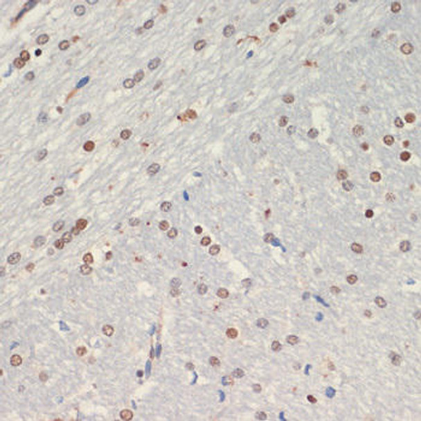 Anti-OLIG2 Antibody (CAB12814)