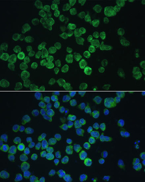 Anti-RIPK3 Antibody (CAB12996)