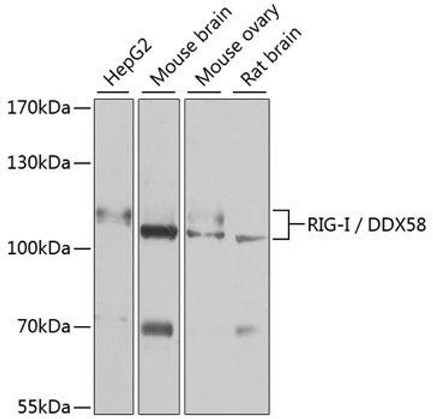 Anti-RIG-I / DDX58 Antibody (CAB13407)