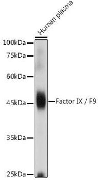 Anti-Factor IX / F9 Antibody (CAB1578)