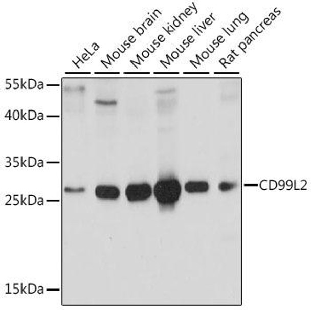 Anti-CD99L2 Antibody (CAB15907)