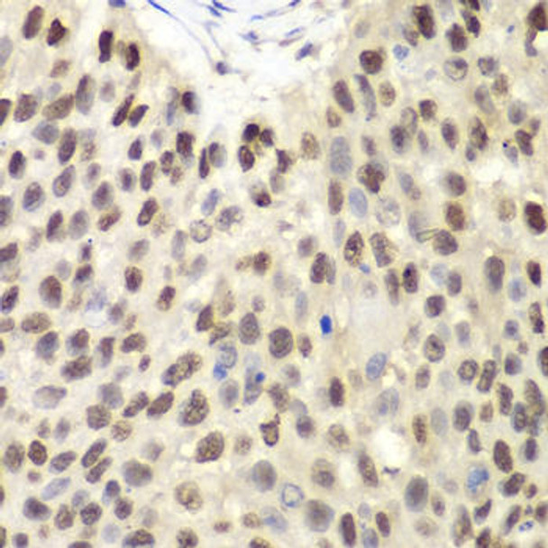 Anti-MCM6 Antibody (CAB1955)