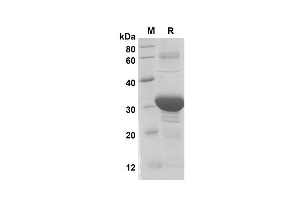 Recombinant Human BMP-2 Protein(Trx Tag) (RPES8021)