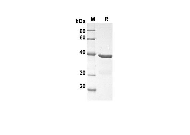 Recombinant Human CT1 Protein(Trx Tag) (RPES8026)