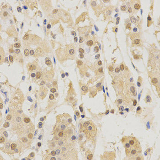Anti-PSMB5 Antibody (CAB1975)
