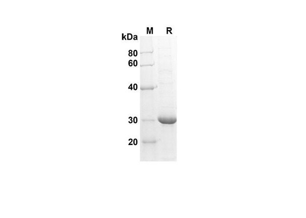 Recombinant Human CXCL6/GCP-2 Protein(Trx Tag) (RPES8074)