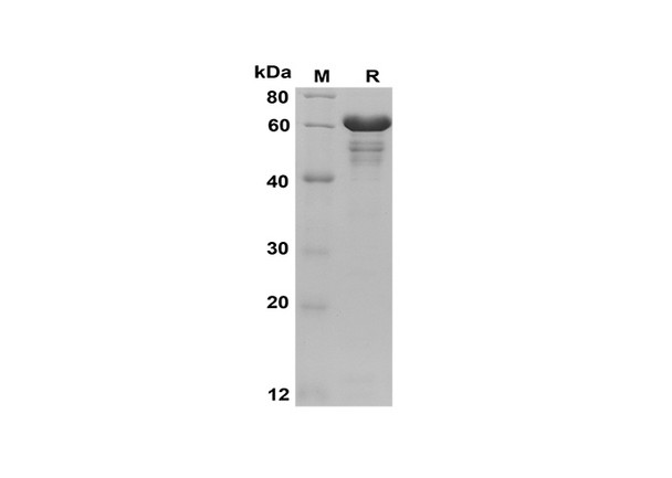 Recombinant Human GS Protein(Trx Tag) (RPES8085)