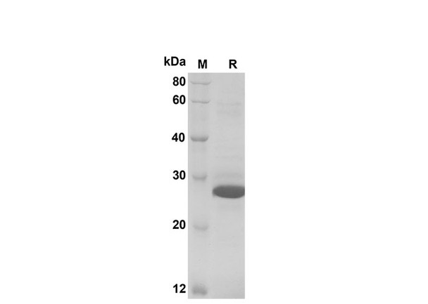 Recombinant Human CCL27/CTACK Protein(Sumo Tag) (RPES8106)