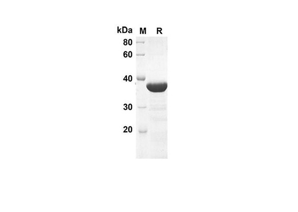 Recombinant Mouse SHH Protein(Trx Tag) (RPES8150)