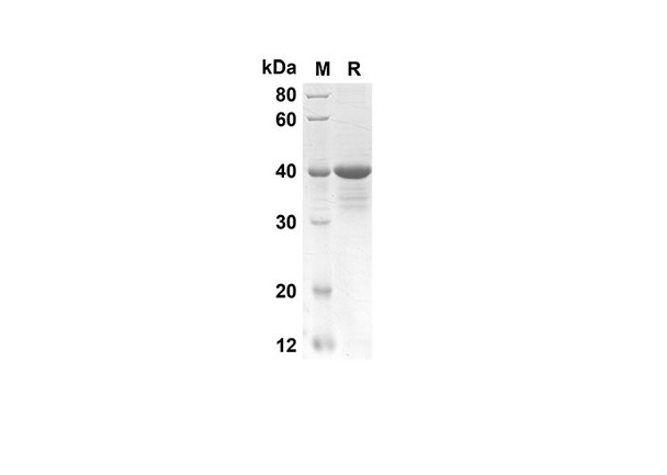 Recombinant Mouse Ebi3 Protein(Trx Tag) (RPES8158)