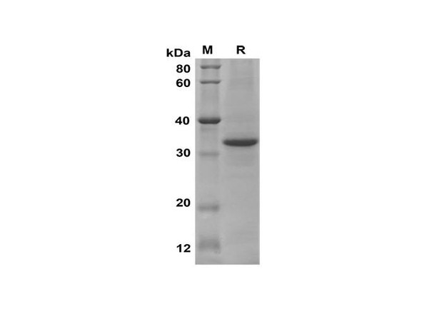 Recombinant Mouse BMP-9 Protein(Trx Tag) (RPES8189)