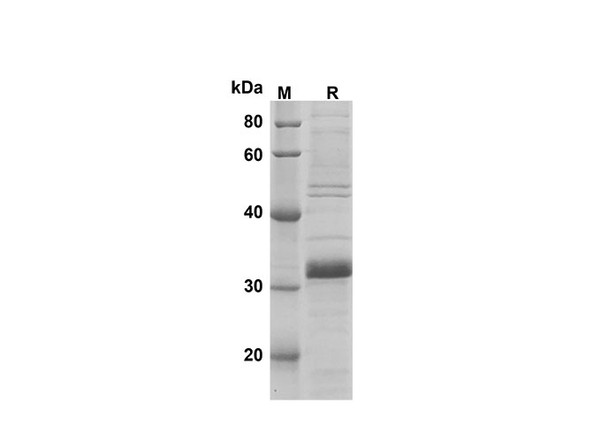 Recombinant Mouse LY6G Protein(Trx Tag) (RPES8201)