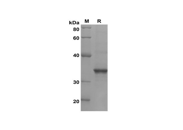 Recombinant Mouse CCL25/TECK Protein(Trx Tag) (RPES8202)