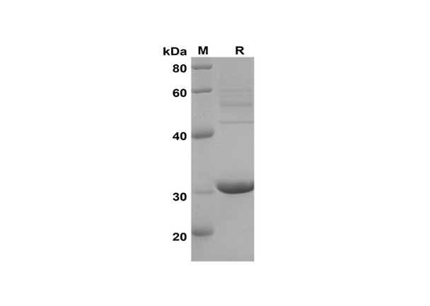 Recombinant Mouse CXCL1/Lymphotactin1/I-TAC Protein(Trx Tag) (RPES8206)