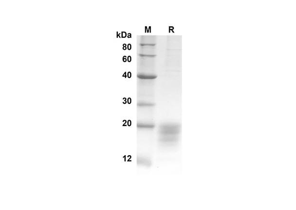 Recombinant Human IL5 Protein(His Tag) (RPES8260)