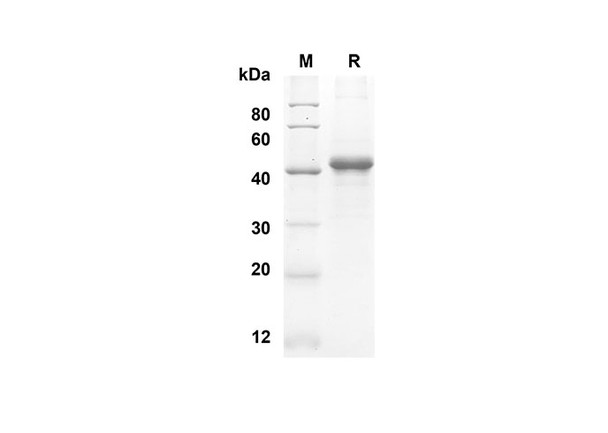 Recombinant Human sCD40L Protein(Fc Tag) (RPES8266)