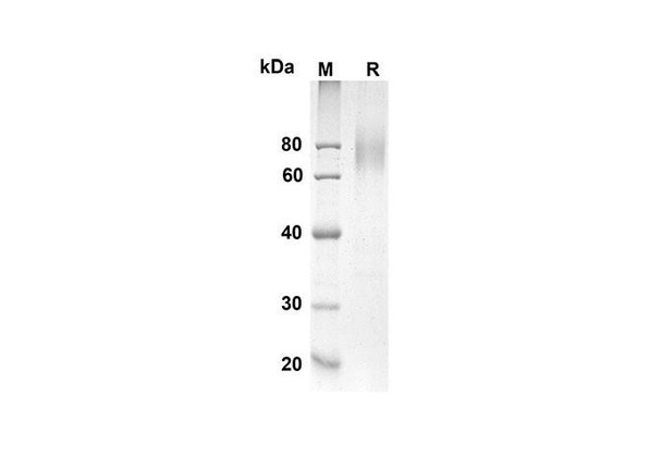 Recombinant Human IL7R Protein (Fc Tag) (RPES8291)