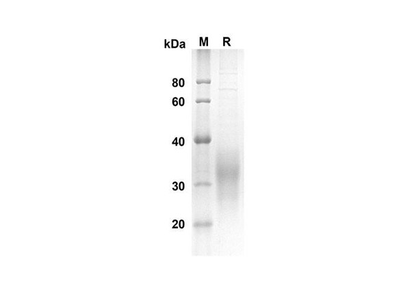 Recombinant Human SCF Protein (His Tag) (RPES8305)