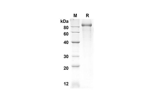 Recombinant Human NRP1 Protein (His Tag) (RPES8308)