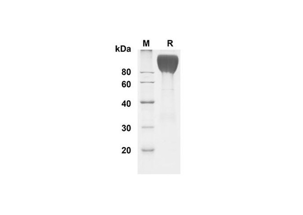 Recombinant Human CEACAM-1/CD66a Protein (Fc Tag) (RPES8340)