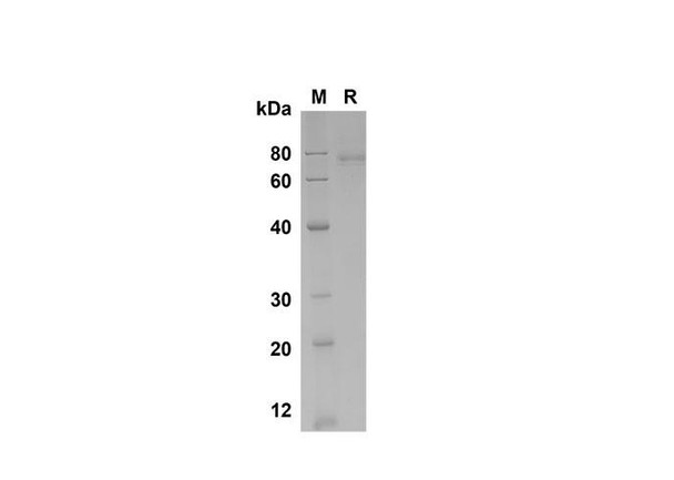 Recombinant Human GASP-1/WFIKKNRP Protein (His Tag) (RPES8354)